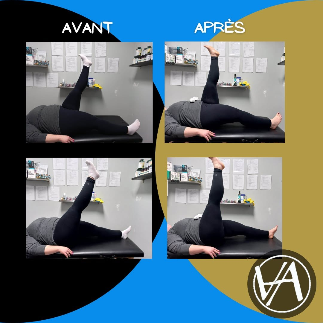 Comparaison avant et après d’une élévation active de jambe