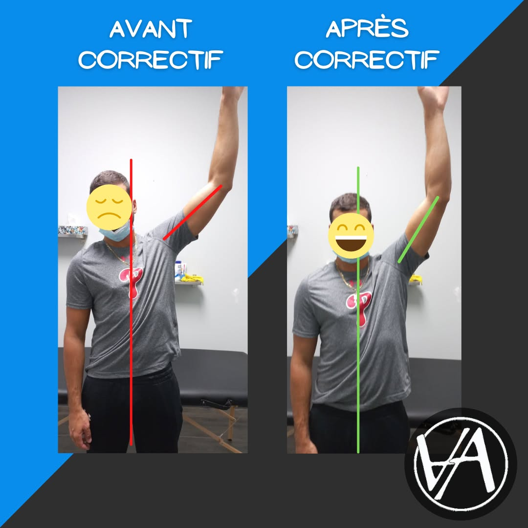 Comparaison d’un test d’épaule avant et après
